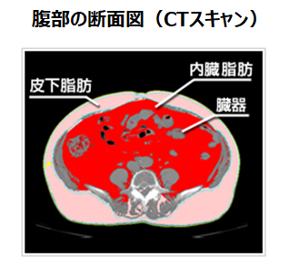 腹部の断面図（CTスキャン）