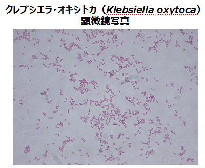 K.oxytocaの顕微鏡写真